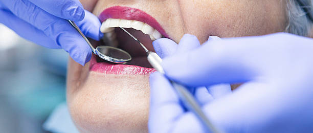 Best Emergency Treatment for Dental Infections or Abscesses in Roaring Spring, PA