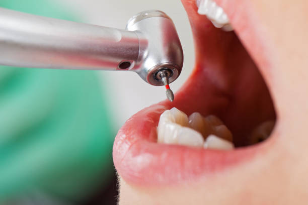 Best Emergency Dental Care for Broken or Chipped Teeth in Roaring Spring, PA